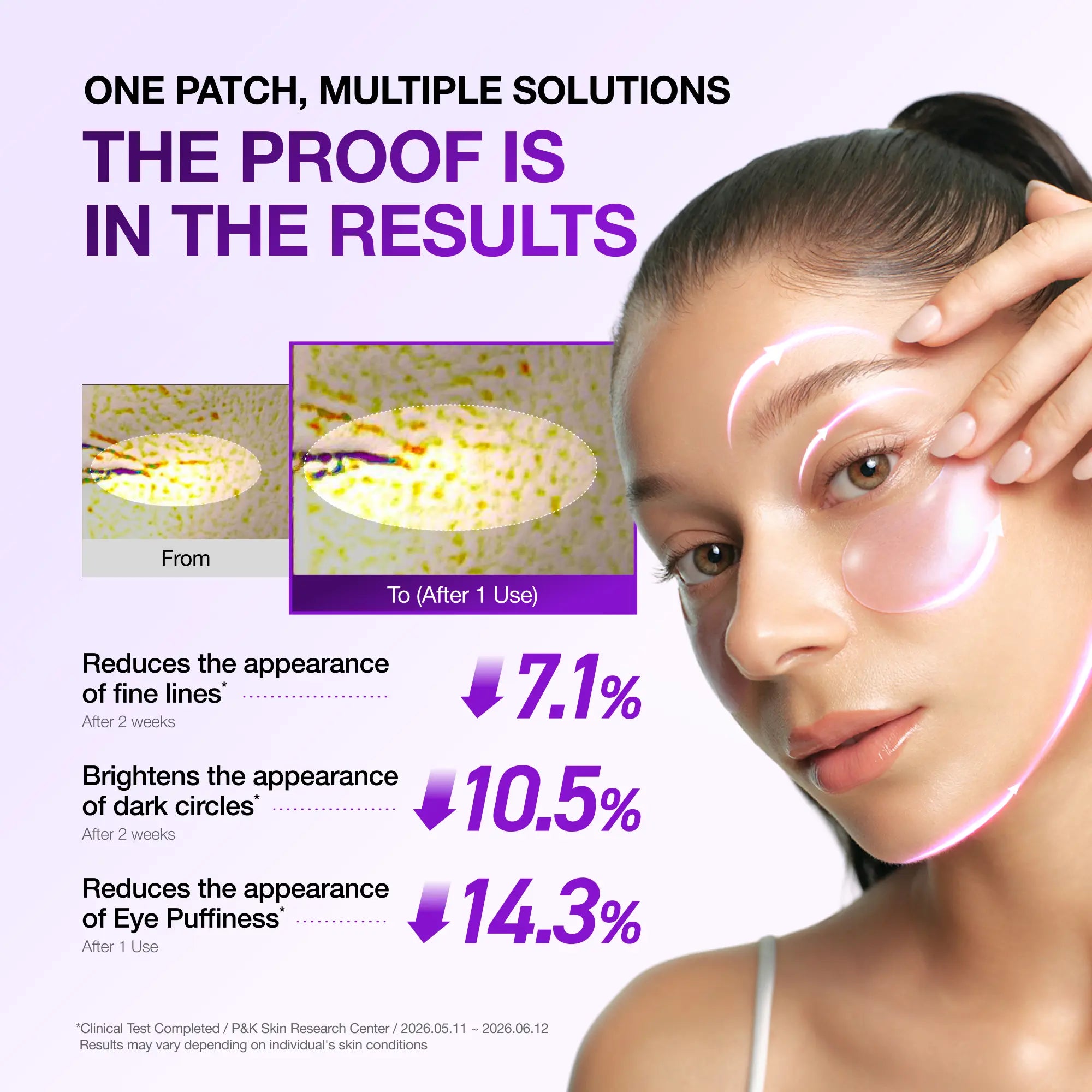 Revitalize Your Eyes with Anua Retinol Berry Eye Patches - 60 Count for Youthful, Bright Skin in Just 10 Minutes!